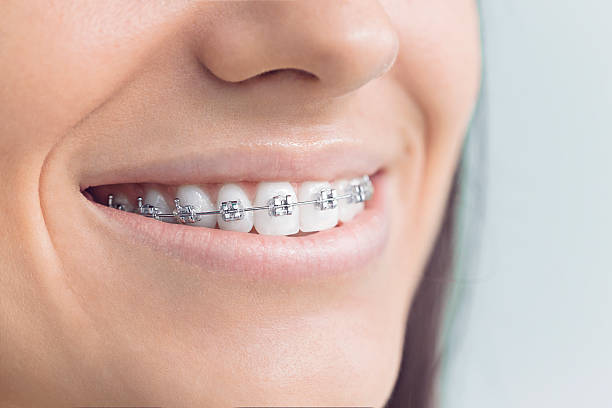 Dental Inlays and Onlays in Hicksville, NY
